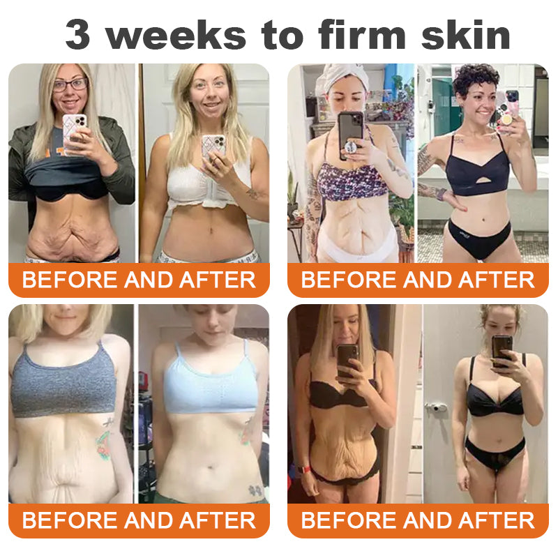 Only 6 jars left! We're offering you an extra 30% off! ⏰⏰ClearaSkin™ Recommended by dermatologists, 4-5 jars will restore your perfect skin! If you miss this opportunity, you'll have to wait until next year to buy!