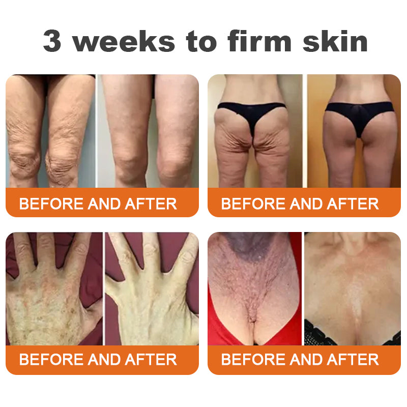 Only 6 jars left! We're offering you an extra 30% off! ⏰⏰ClearaSkin™ Recommended by dermatologists, 4-5 jars will restore your perfect skin! If you miss this opportunity, you'll have to wait until next year to buy!