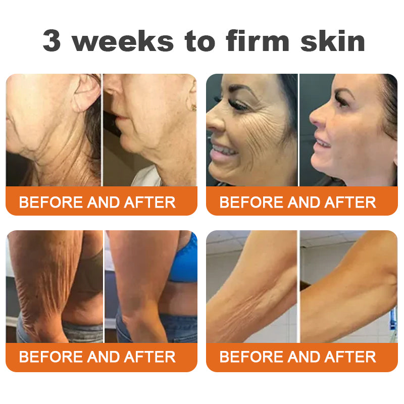 Only 6 jars left! We're offering you an extra 30% off! ⏰⏰ClearaSkin™ Recommended by dermatologists, 4-5 jars will restore your perfect skin! If you miss this opportunity, you'll have to wait until next year to buy!
