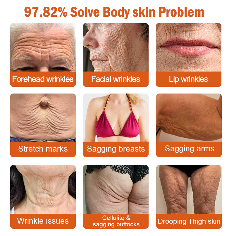 Only 6 jars left! We're offering you an extra 30% off! ⏰⏰ClearaSkin™ Recommended by dermatologists, 4-5 jars will restore your perfect skin! If you miss this opportunity, you'll have to wait until next year to buy!