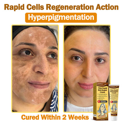 Only 6 tubes left! We're offering you an extra 30% off! 𝐀𝐞𝐞𝐡𝐟𝐞𝐧𝐠®🌈 Recommended by dermatologists, 4-5 tubes will restore your perfect skin! If you miss this opportunity, you'll have to wait until next year to buy!