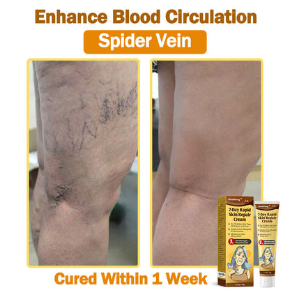 Only 6 tubes left! We're offering you an extra 30% off! 𝐀𝐞𝐞𝐡𝐟𝐞𝐧𝐠®🌈 Recommended by dermatologists, 4-5 tubes will restore your perfect skin! If you miss this opportunity, you'll have to wait until next year to buy!