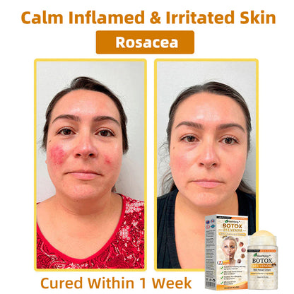 𝐑𝐨𝐲𝐚𝐥 𝐌𝐞𝐥𝐛𝐨𝐮𝐫𝐧𝐞 𝐇𝐨𝐬𝐩𝐢𝐭𝐚𝐥 𝐎𝐟𝐟𝐢𝐜𝐢𝐚𝐥: 𝐀𝐞𝐞𝐡𝐟𝐞𝐧𝐠® 𝐁𝐎𝐓𝐎𝐗  𝐁𝐞𝐞 𝐕𝐞𝐧𝐨𝐦 𝐒𝐤𝐢𝐧 𝐑𝐞𝐩𝐚𝐢𝐫 𝐂𝐫𝐞𝐚𝐦🏆🔥 𝐀𝐧𝐭𝐢-𝐚𝐠𝐢𝐧𝐠, 𝐇𝐲𝐝𝐫𝐚𝐭𝐢𝐧𝐠, 𝐒𝐤𝐢𝐧 𝐑𝐞𝐩𝐚𝐢𝐫, 𝐄𝐯𝐞𝐧 𝐓𝐨𝐧𝐞, 𝐀𝐜𝐧𝐞 𝐚𝐧𝐝 𝐃𝐚𝐫𝐤 𝐒𝐩𝐨𝐭 𝐓𝐫𝐞𝐚𝐭𝐦𝐞𝐧𝐭, 𝐖𝐚𝐫𝐭 𝐚𝐧𝐝 𝐌𝐨𝐥𝐞 𝐑𝐞𝐦𝐨𝐯𝐚𝐥, 𝐏𝐬𝐨𝐫𝐢𝐚𝐬𝐢𝐬 𝐑𝐞𝐥𝐢𝐞𝐟