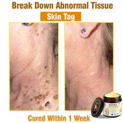 𝐀𝐞𝐞𝐡𝐟𝐞𝐧𝐠® 𝐁𝐎𝐓𝐎𝐗 𝐁𝐄𝐄 𝐕𝐄𝐍𝐎𝐌 𝐒𝐤𝐢𝐧 𝐓𝐫𝐞𝐚𝐭𝐦𝐞𝐧𝐭 𝐂𝐫𝐞𝐚𝐦-⏰𝐋𝐢𝐦𝐢𝐭𝐞𝐝-𝐭𝐢𝐦𝐞 𝟖𝟎% 𝐎𝐅𝐅(🐝🐝𝐀𝐂𝐃 𝐑𝐄𝐂𝐎𝐌𝐌𝐄𝐍𝐃𝐒)