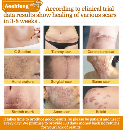 Only 6 tubes left! We're offering you an extra 30% off! 𝐀𝐞𝐞𝐡𝐟𝐞𝐧𝐠®🌈 Recommended by dermatologists, 4-5 tubes will restore your perfect skin! If you miss this opportunity, you'll have to wait until next year to buy!